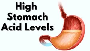 high stomach acid levels
