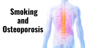 smoking and osteoporosis