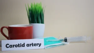 Carotid artery surgery