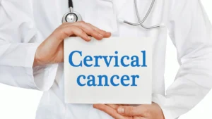cervical cancercervical cancer