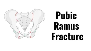 Pubic Ramus Fracture