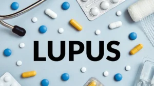 Prednisone for Lupus