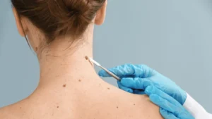 Possible causes of a lump on the back of the neck hairline