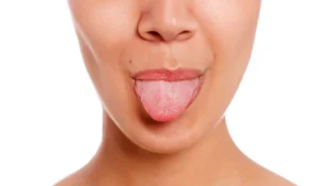 Tongue Tingling
