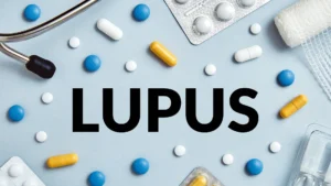 Unveiling Lupus: Recognizing the Initial Symptoms and Seeking Timely Help